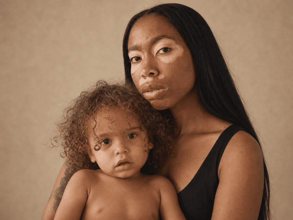Maternal burnout syndrome
