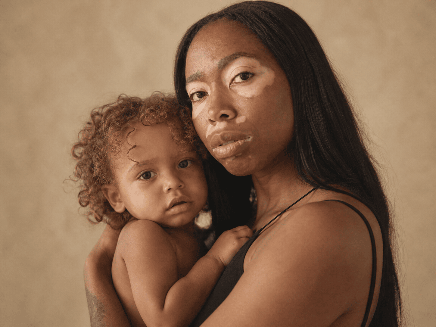 Maternal burnout syndrome